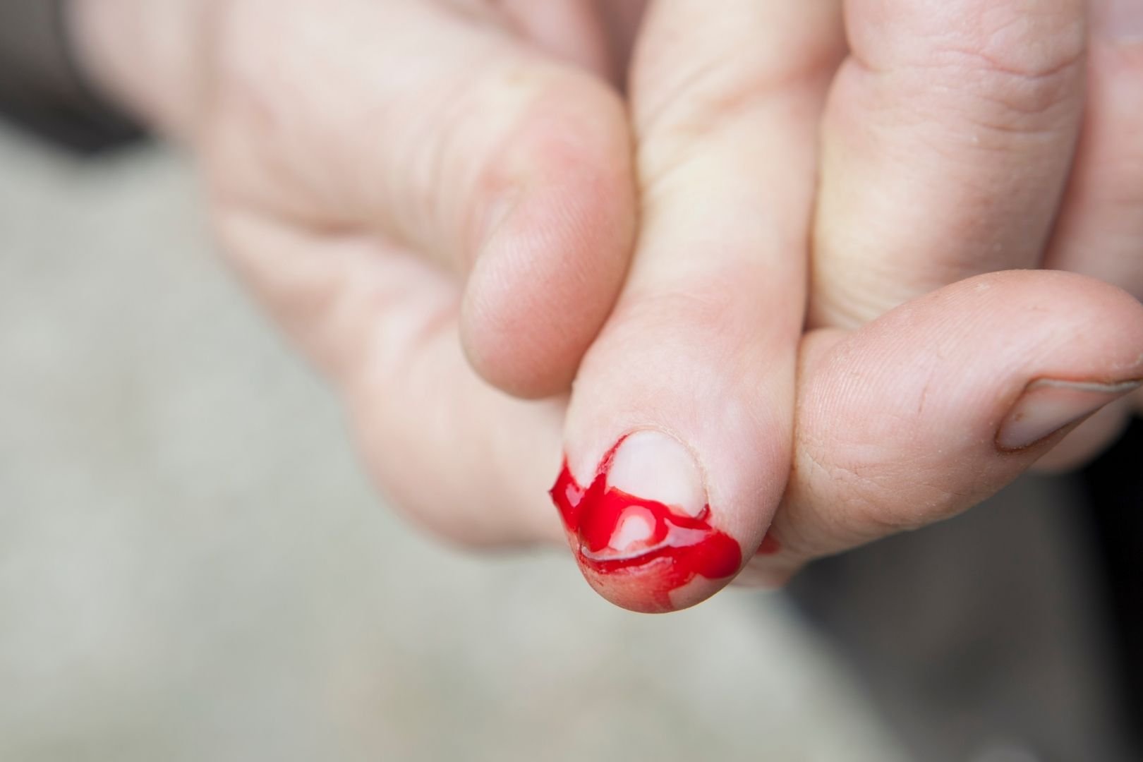 Bleeding cut finger