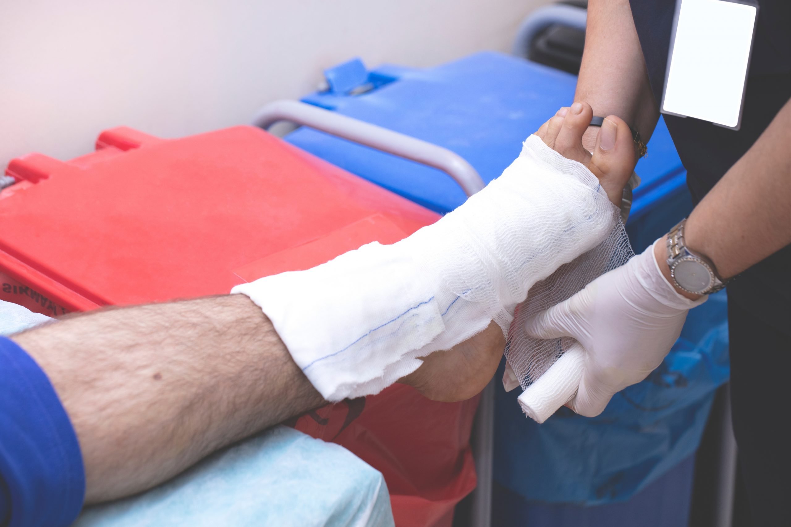 burn of second degree injury of skin